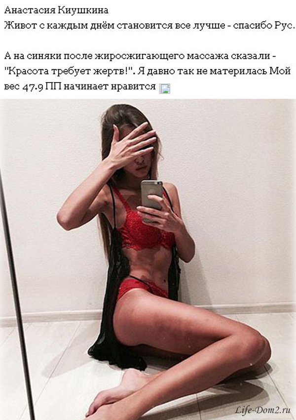 Тело Насти Киушкиной выглядит ужасно. Фото