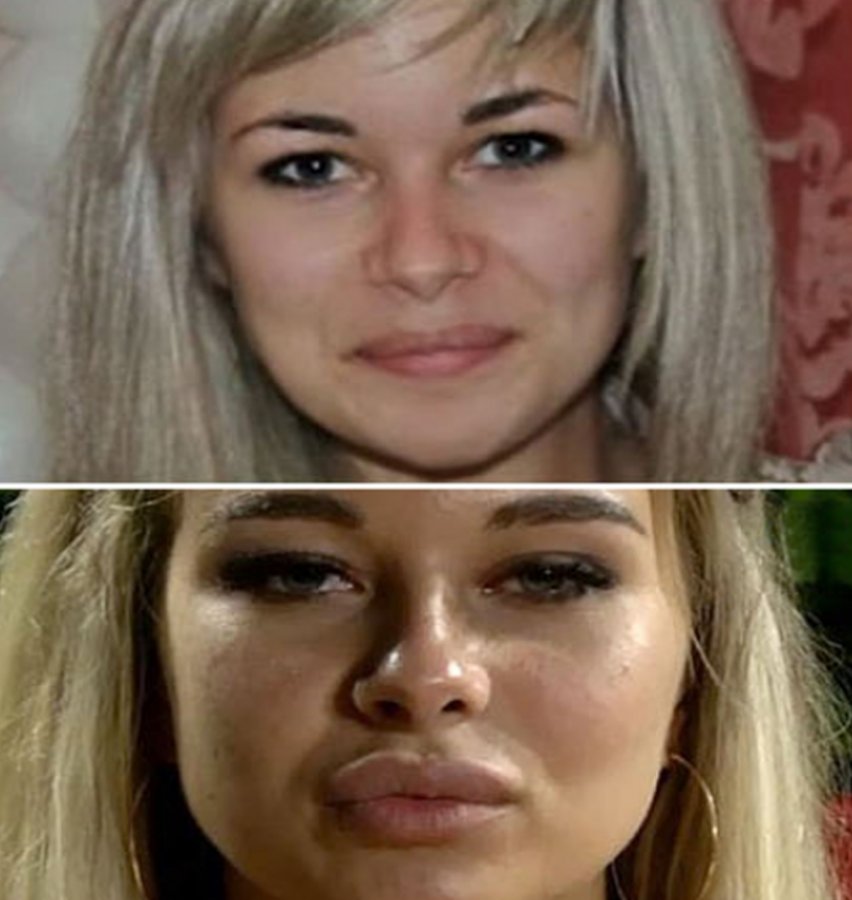 В сети появилось фото Елены Хроминой до и после пластической операции